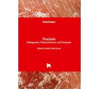 Psoriasis - Pathogenesis, Clinical Features, and Treatment: Pathogenesis, Clinical Features, and Treatment