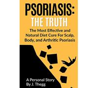 Psoriasis: The Truth: The Most Effective and Natural Diet Cure for Scalp, Body, and Arthritic Psoriasis: Volume 1 (Psoriasis treatment psoriasis shampoo psoriasis cream psoriasis lotion)