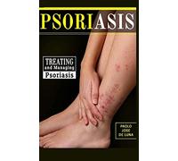 Psoriasis: Treating and Managing Psoriasis