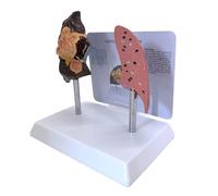 Puffing Lung Vs Comparative Model for Clinical Education Permanent PVC Structure Teaching Tool Health Education Comparison