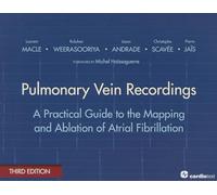 Pulmonary Vein Recordings: A Practical Guide to the Mapping and Ablation of Atrial Fibrillation