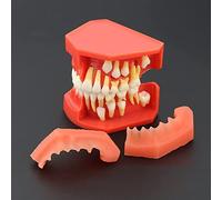 PURFWOG Children's Deciduous Teeth Model, Tooth Eruption Development Model, Alternate Display Model of Teeth, Oral Model, Doctor-Patient Communication Show Tooth Model
