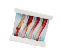 PVC Vascular Model Dynamic Blood Vessel Demonstration Education Tool Ideal for Nursing and Anatomy Education Purposes Enlarged Clinical Model