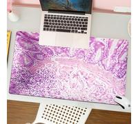 QRFASFZO Mouse Pad 31.5 × 12 inch Extended Large Mouse Mat Desk Pad, Stitched Edges Mousepad,Non-Slip Rubber Base,View in microscopic of ductal cell carcinoma adenonocarcinoma fro,Gaming Mouse Pad XL