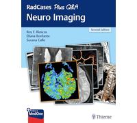 RadCases Plus Q&A: Neuro Imaging