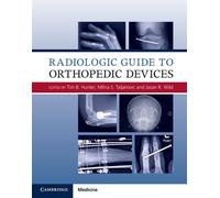 Radiologic Guide to Orthopedic Devices by Tim B. Hunter (English) Hardcover Book