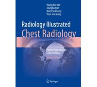 Radiology Illustrated: Chest Radiology : Pattern Approach for Lung Imaging