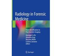 Radiology in Forensic Medicine: From Identification to Post-mortem Imaging