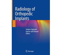 Radiology of Orthopedic Implants