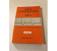 Rapid Interpretation of EKG's