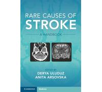 Rare Causes of Stroke: A Handbook