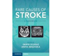Rare Causes of Stroke: A Handbook