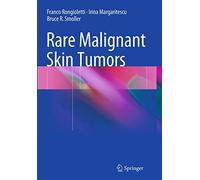 Rare Malignant Skin Tumors