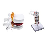 Rdjumpdjo 1 Pcs Human Anatomy Skeleton Spine Lumbar Disc Teaching Model & 1 Pcs Cervical Vertebra Arteria Spine Nerves Model