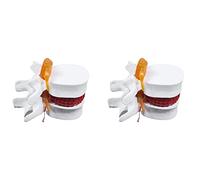 Rdjumpdjo 2X Human Anatomy Skeleton Spine Lumbar Disc Herniation Teaching Model Brain Skull Traumatic School Supplies Instrume