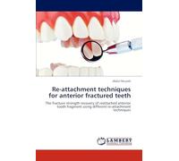 Re-attachment techniques for anterior fractured teeth: The fracture strength recovery of reattached anterior tooth fragment using different re-attachment techniques