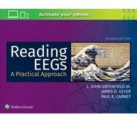 Reading EEGs: A Practical Approach