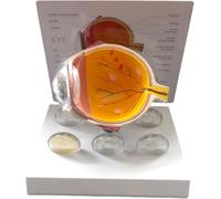 Realistic Human Anatal Eye Model for Glaucoma Teaching Demonstration and Educational Purposes