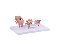 Realistic Human Embryo Development Model with Detachable Five Parts for Medical Education Educational Tool for Human Fetal Embryo Development Five Part Detachable Model Realistic Anatomy for Training