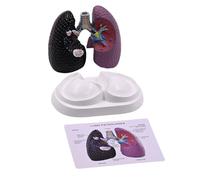 Realistic Lung Anatomy Model Anatomical Human Teaching Tool Normal and Pathological Study Model