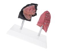 Realistic Puffing Lung Vs Not Smoker Educational Model Permanent PVC Structure Demonstration Tool PVC Demonstration Tool Pathological Structure Model Health Education Comparison