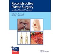 Reconstructive Plastic Surgery: An Atlas of Essential Procedures – Thieme