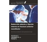 Reducción abierta y fijación interna en fractura anterior mandibular: De la fractura a la fijación: Visión general de la cirugía
