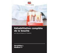 Réhabilitation complète de la bouche: par des prothèses sur implants
