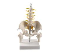 Removable Lumbar Vertebrae With Pelvis Leg Bones，Lumbar Spine Anatomy Model With Sacrum And Spinal Nerves, Didactic Replica Of Lumbosacral Section With Nerves And A Herniated Disc, Includes Base For