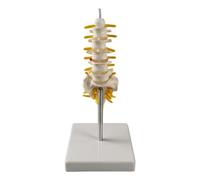 Removable Lumbar Vertebrae With Pelvis Leg Bones，Lumbar Spine Anatomy Model With Sacrum And Spinal Nerves, Didactic Replica Of Lumbosacral Section With Nerves And A Herniated Disc, Includes Base For