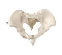 Removable Lumbar Vertebrae With Pelvis Leg Bones，Lumbar Spine Anatomy Model With Sacrum And Spinal Nerves, Didactic Replica Of Lumbosacral Section With Nerves And A Herniated Disc, Includes Base For