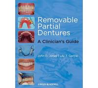 Removable Partial Dentures: A Clinician's Guide (Restorative Dentistry)
