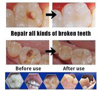 Repair Cement Teeth Gap Falseteeth Solid Glue Set Tooth Filling Kit Temporary Dental Fake Teeth Glue Tooth Gaps