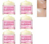 Retinol Cream for Face Neck with Hyaluronic Acid & Hydrolyzed Collagen, Anti-Aging Firming Moisturizer Reduce Fine Lines, Wrinkles Crepey Skin, Brightens Skin, Day Night Cream (6Pcs)