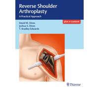Reverse Shoulder Arthroplasty : A Practical Approach