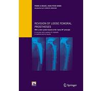 Revision of loose femoral prostheses with a stem system based on the "press-fit" principle: A concept and its system of implants, a method and its results