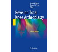 Revision Total Knee Arthroplasty