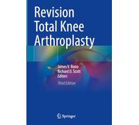 Revision Total Knee Arthroplasty – Springer Verlag