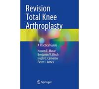Revision Total Knee Arthroplasty: A Practical Guide