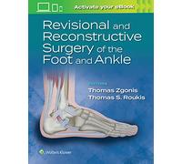 Revisional and Reconstructive Surgery of the Foot and Ankle