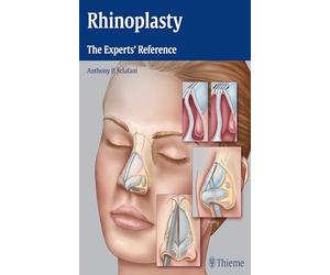 Rhinoplasty: The Experts' Reference