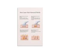RNUMLIGH Laser Hair Removal Technology Educational Poster Science Explained Visual Guide 4 Step Process Wall-Art for Salon Spa Decor(Framed,08x12inch(20x30cm))