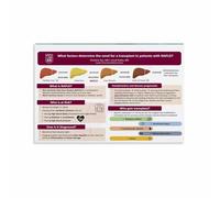 RNUMLIGH Understanding Your Liver Poster Informative Health Education Chart Motivational Wall-Art for Gym Study Room(Unframed,08x12inch(20x30cm))