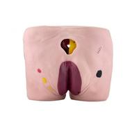 RoaQinFo Pressure Wound Care Training Model Realistic, Pressure Sore Care Instruction Model, Hands on, for Training s, Nursing Students, Style B