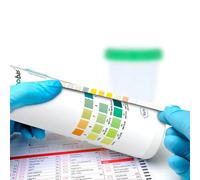 Roche Combur 3 Urine Test Strips 50 Pcs Analog