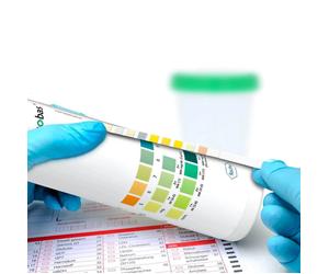 Roche Combur 3 Urine Test Strips 50 Pcs Analog