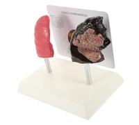 ROMISBABA Pathological Lung Anatomy Model PVC Material Display Teaching Aid for Schools Smoking Lung Educational Medical Visual Aid