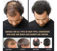 Root Activator Shampoo, Spartan Hair Loss Shampoo,shampoo Root Activator