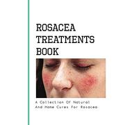 Rosacea Treatments Book- A Collection Of Natural And Home Cures For Rosacea: Rosacea Treatment