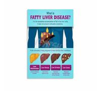 RUAJOGYNVM Doctor Office Decor - Fatty Liver Disease Educational Reference Chart, Poster for Clinic, Hospital & Health Classroom(Unframed,12x18inch(30x45cm))